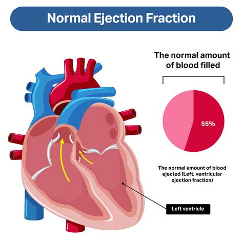 normal systolic ejection fraction.